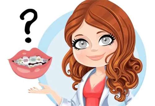 正畸价格是多少钱?正畸需要多长时间?影响因素插图3 正畸价格是多少钱?正畸需要多长时间?影响因素插图3