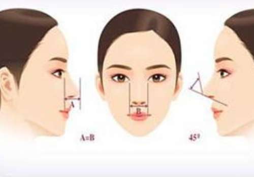 做一个鼻梁大概要多少钱?选什么方式好?插图2 做一个鼻梁大概要多少钱?选什么方式好?插图2
