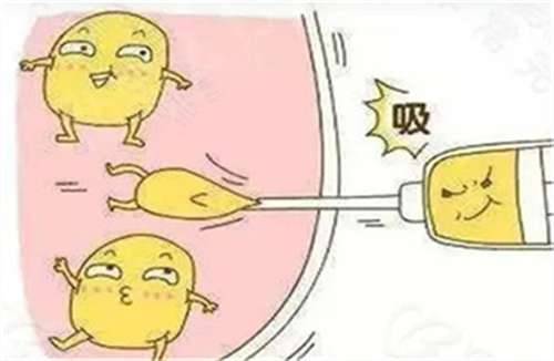 吸脂瘦脸要多少钱?看全新价格汇总,点击查看插图2 吸脂瘦脸要多少钱?看全新价格汇总,点击查看插图2