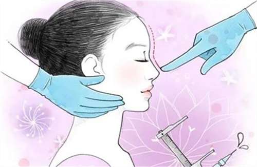 膨体鼻基底填充多少钱?科普知识讲解插图2 膨体鼻基底填充多少钱?科普知识讲解插图2
