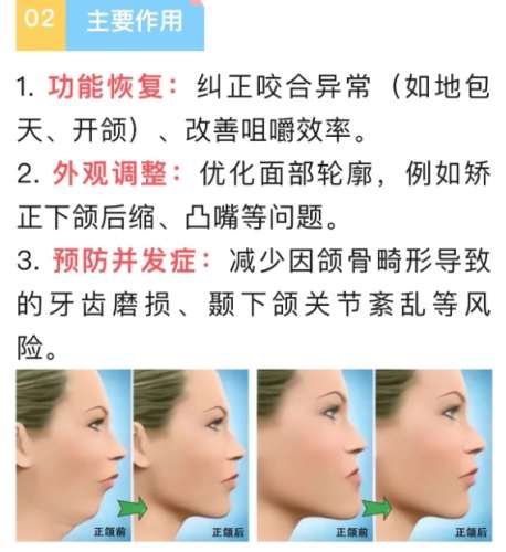 山东省立医院正颌手术怎么样?手术价格明细表更新插图4 山东省立医院正颌手术怎么样?手术价格明细表更新插图4