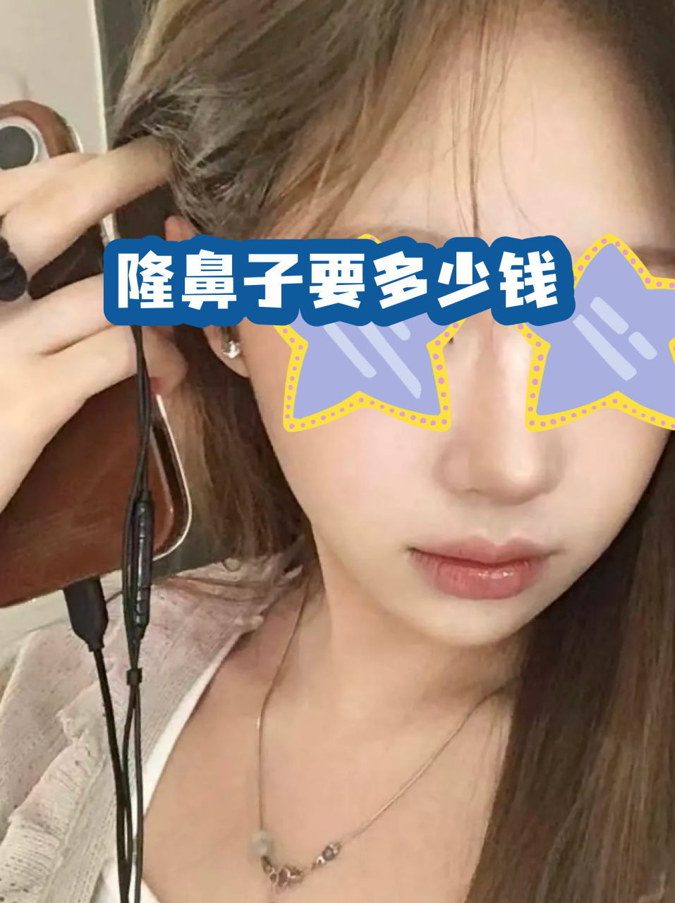 杭州肋软骨隆鼻价格多少钱?影响价格的因素有哪些插图1 杭州肋软骨隆鼻价格多少钱?影响价格的因素有哪些插图1
