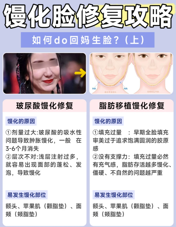 南京馒化脸修复多少钱?南京面部美容修复价格及医院推荐插图 南京馒化脸修复多少钱?南京面部美容修复价格及医院推荐插图