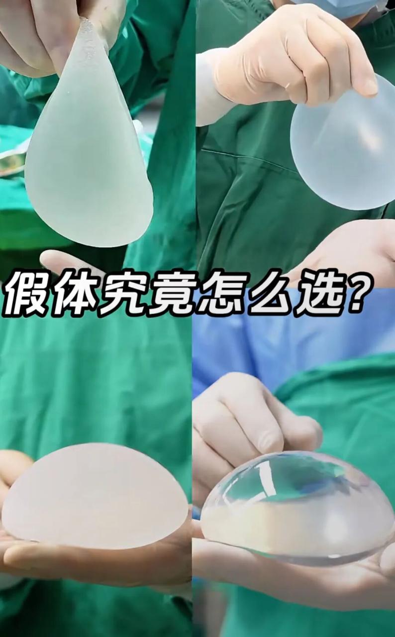 隆胸的假体材料有哪些?做了假体隆胸会很硬吗?插图 隆胸的假体材料有哪些?做了假体隆胸会很硬吗?插图