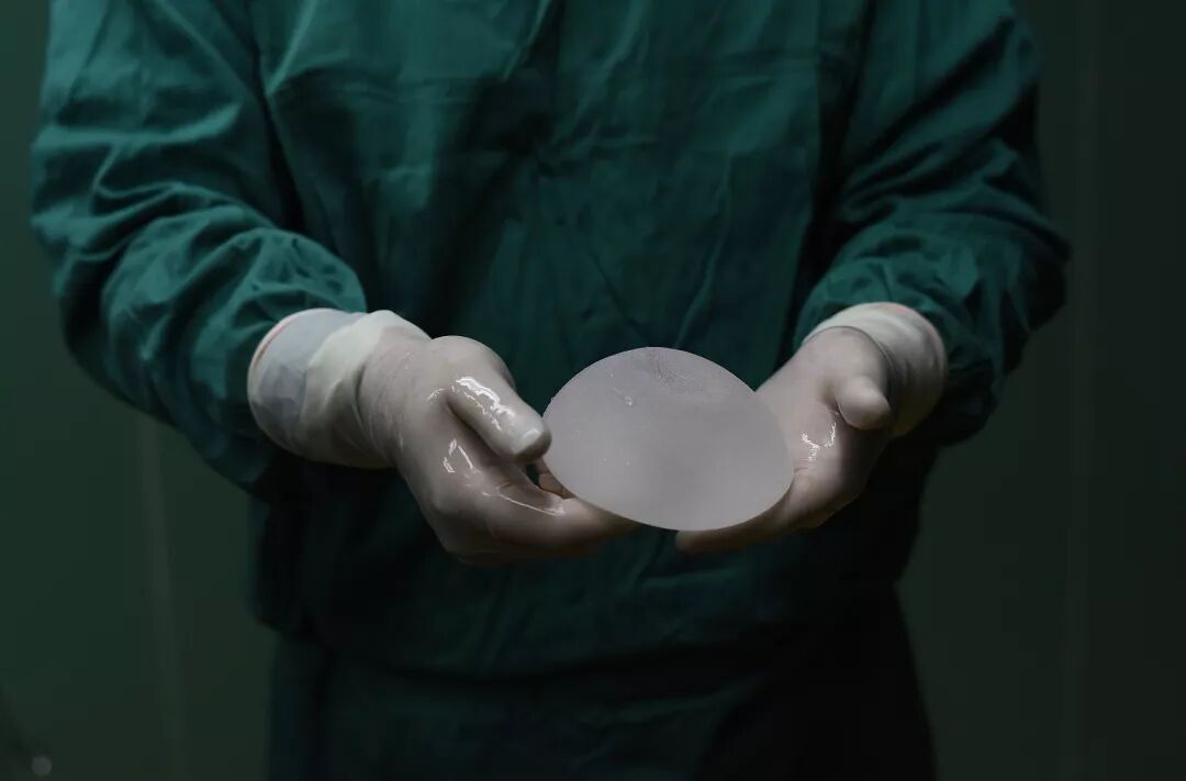 隆胸假体更换有危险吗?隆胸假体取出多长时间?插图 隆胸假体更换有危险吗?隆胸假体取出多长时间?插图