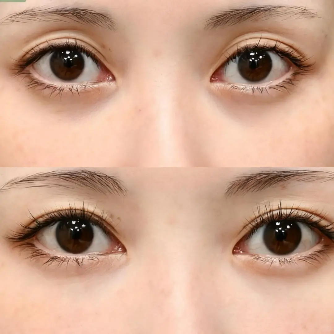 杭州眼修复价格多少钱?杭州眼修复医院推荐插图 杭州眼修复价格多少钱?杭州眼修复医院推荐插图