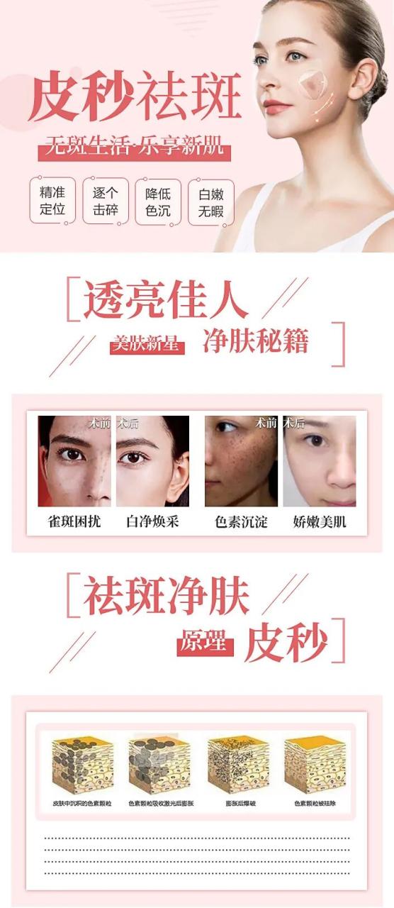 杭州超皮秒祛斑价格多少钱?超皮秒去除斑点一次需要多少费用插图 杭州超皮秒祛斑价格多少钱?超皮秒去除斑点一次需要多少费用插图