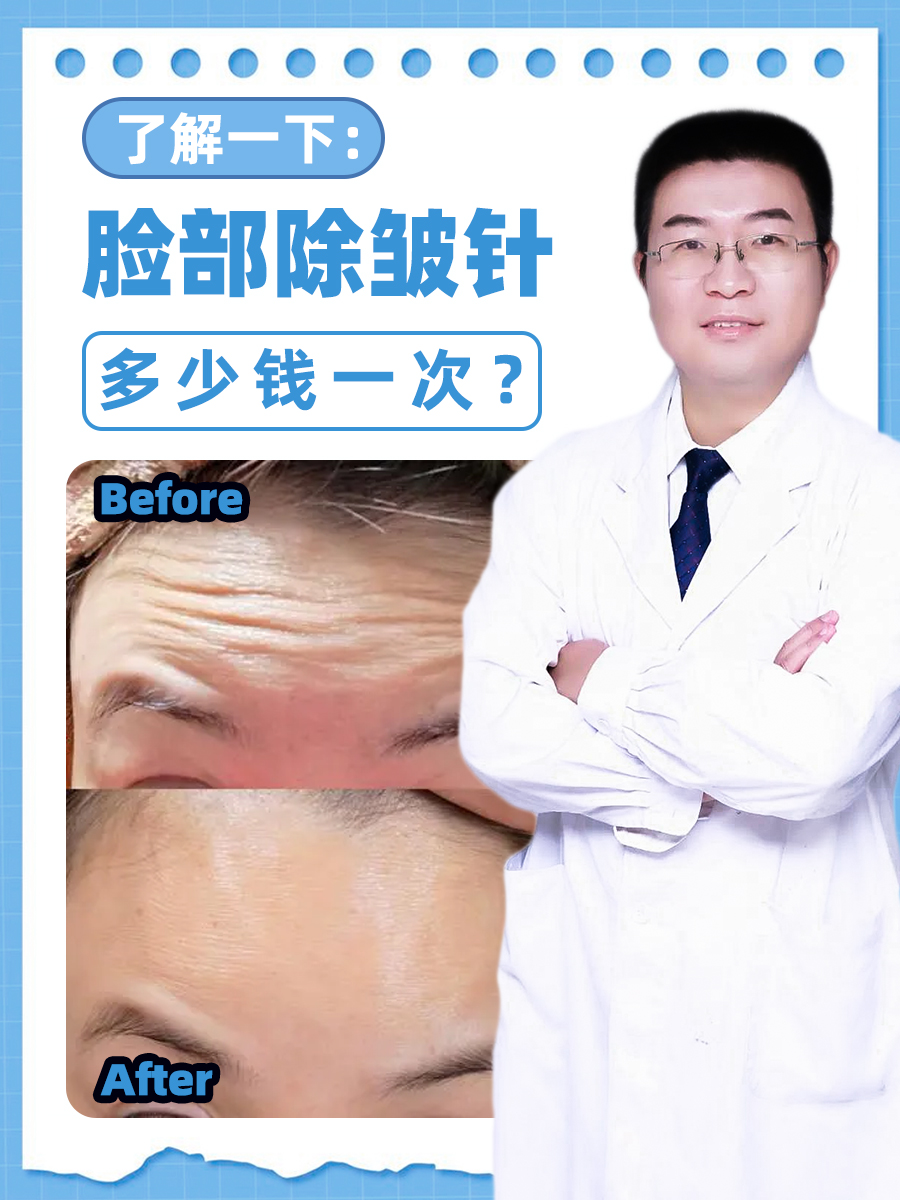 南京除皱针价格多少钱?了解南京皱针最新报价与选择指南插图2 南京除皱针价格多少钱?了解南京皱针最新报价与选择指南插图2