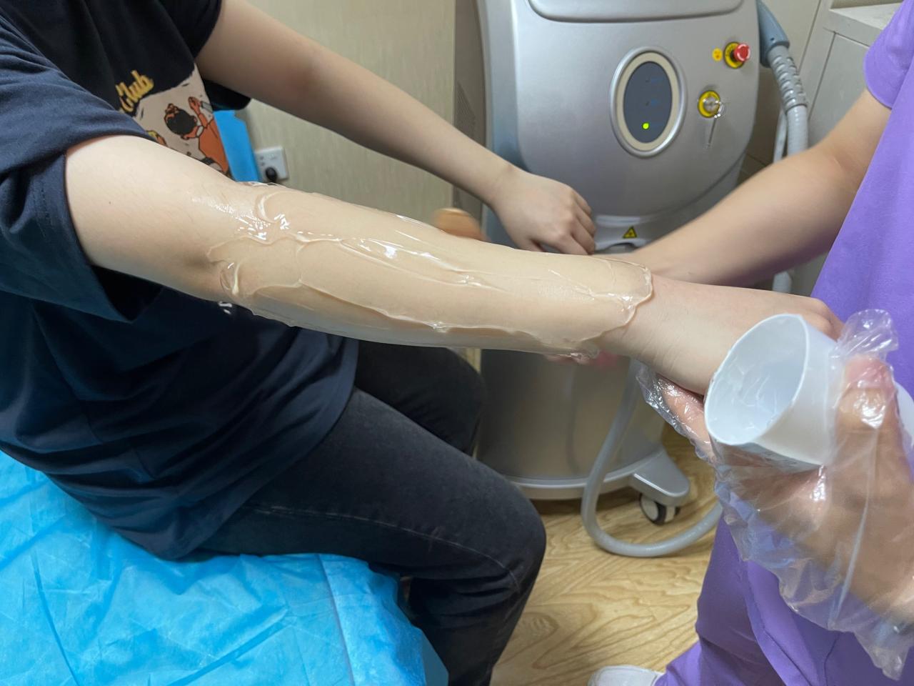 杭州冰点脱毛多少钱一次?最新报价指南插图1 杭州冰点脱毛多少钱一次?最新报价指南插图1