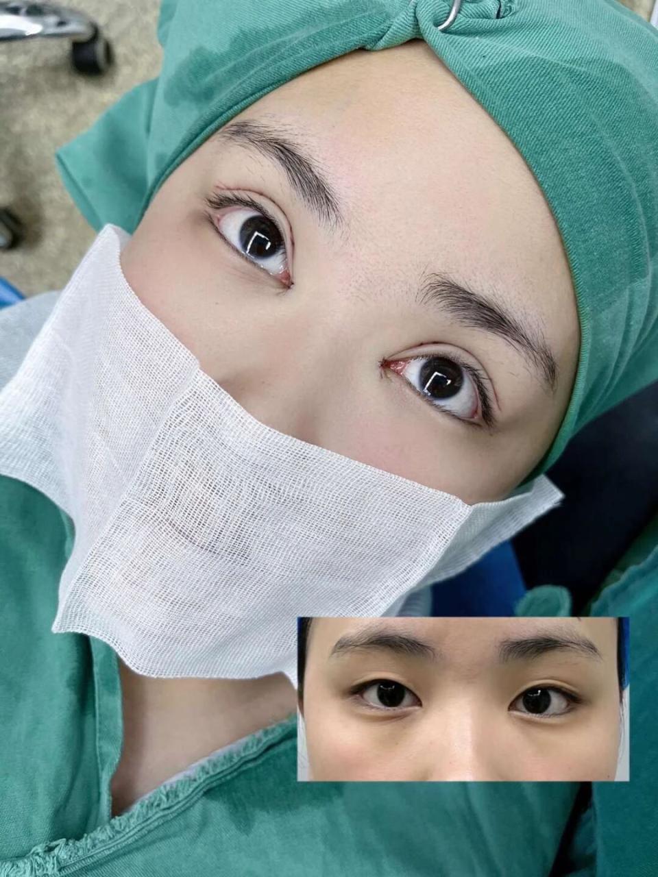 杭州眼综合手术价格多少钱?了解杭州地区眼部整形美容最新报价及注意事项插图 杭州眼综合手术价格多少钱?了解杭州地区眼部整形美容最新报价及注意事项插图