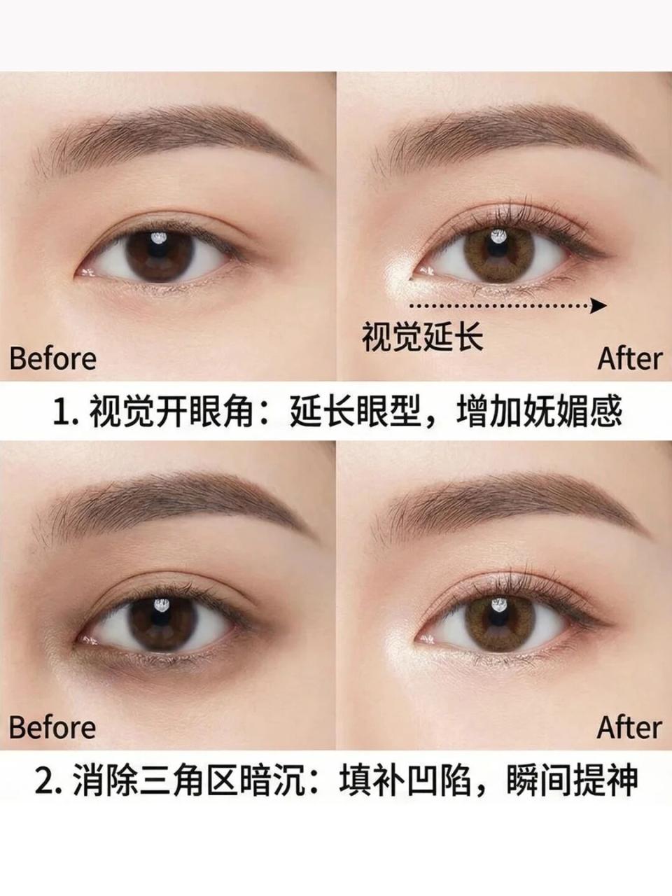 杭州开眼角多少钱?如何选择合适的医院很重要插图 杭州开眼角多少钱?如何选择合适的医院很重要插图