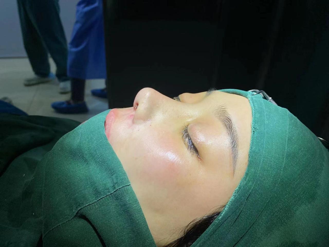 杭州鼻修复手术价格多少钱?如何选择性价比高的鼻修复医院?插图 杭州鼻修复手术价格多少钱?如何选择性价比高的鼻修复医院?插图