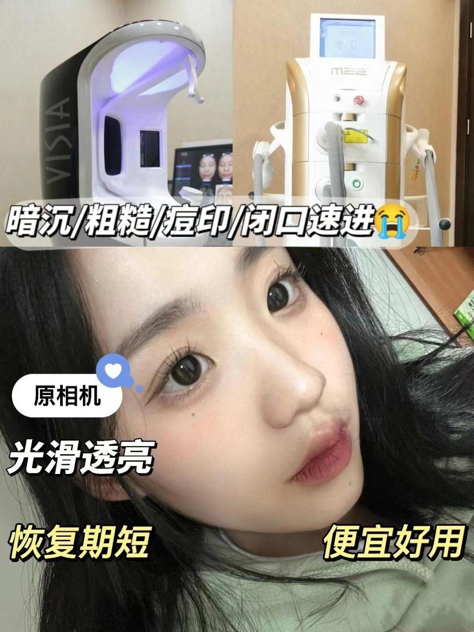 2026年杭州光子嫩肤价格表 | 杭州最新光子嫩肤费用及优惠活动插图1 2026年杭州光子嫩肤价格表 | 杭州最新光子嫩肤费用及优惠活动插图1