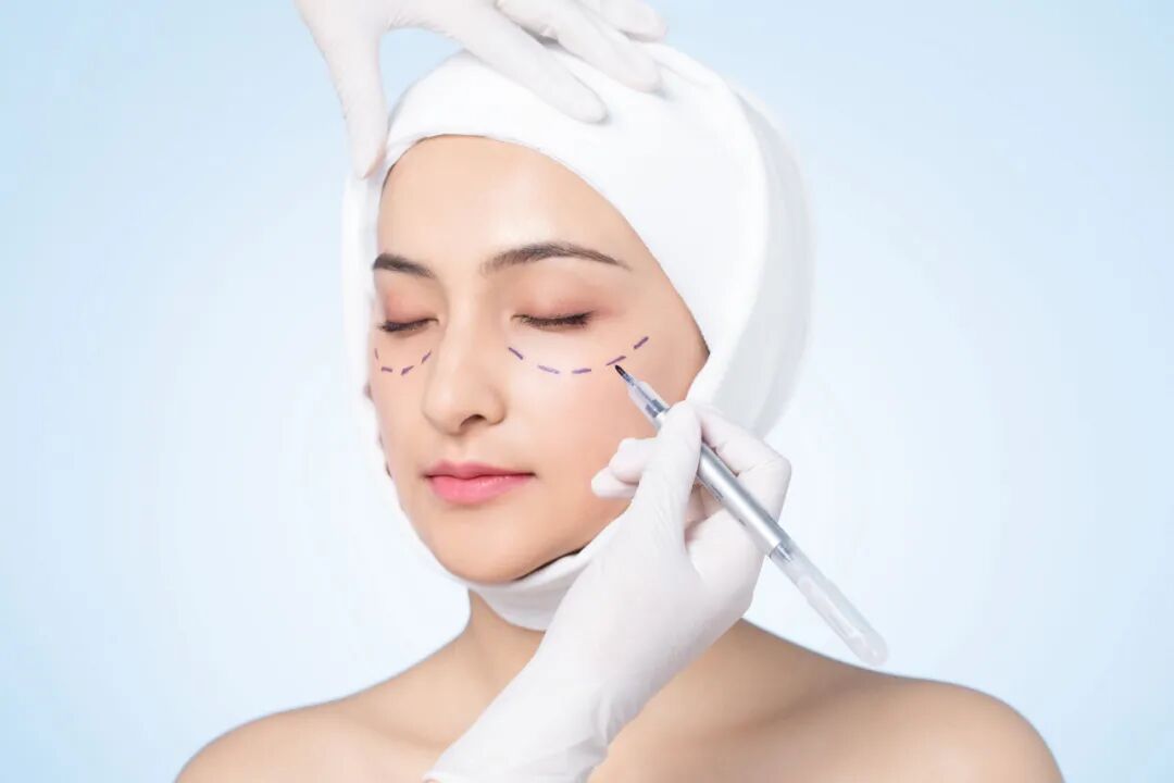 眼部抽脂后会反弹吗？眼部抽脂后有什么后遗症？