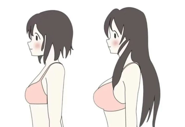 假体隆胸后还可以自体脂肪隆胸吗？插图