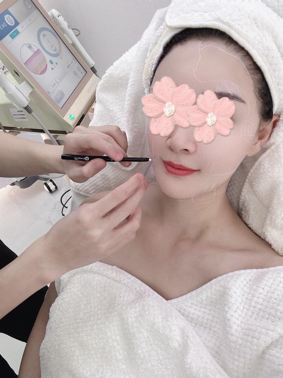 厦门艺星匡凯英医生做超声炮效果如何?体验分享及效果评价插图1 厦门艺星匡凯英医生做超声炮效果如何?体验分享及效果评价插图1