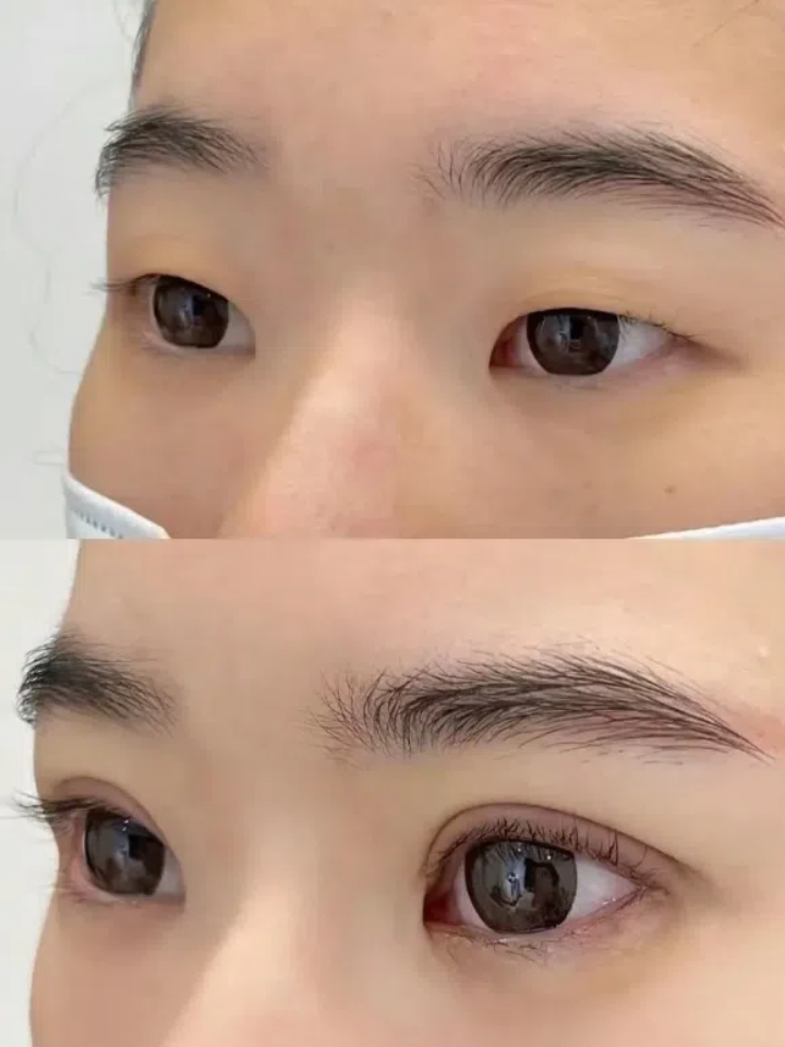 武汉韩式双眼皮整形医院推荐 | 专业韩式双眼皮手术哪家医院好?插图1 武汉韩式双眼皮整形医院推荐 | 专业韩式双眼皮手术哪家医院好?插图1