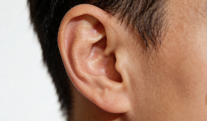 耳部整形