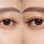 2026年江苏眼部整形医院排行榜，开眼角医院榜单分享！