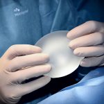 挑选硅胶隆胸医生避坑指南：从排名榜单、真人案例到术后反馈全解析