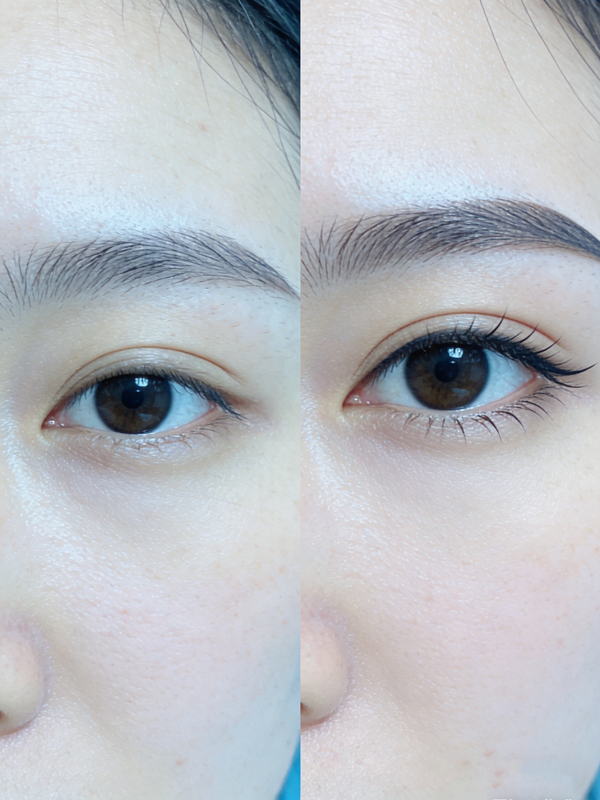 如何判断自己的眼皮松弛程度？