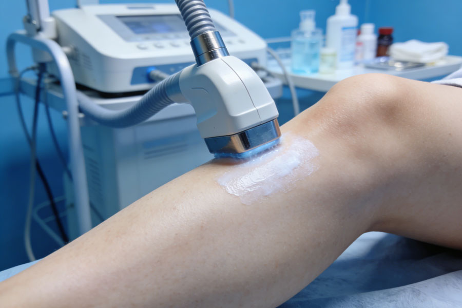 冷冻溶脂瘦小腿