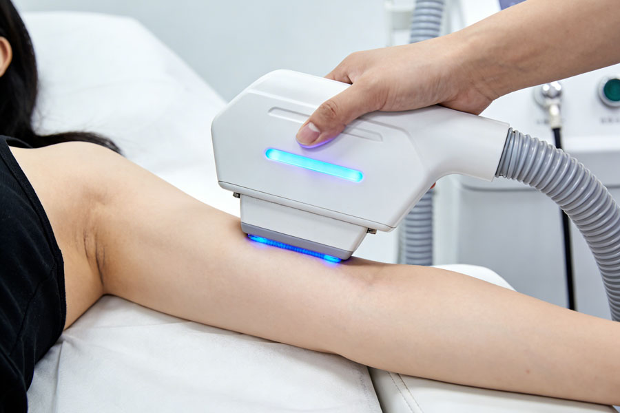 冷冻溶脂瘦手臂