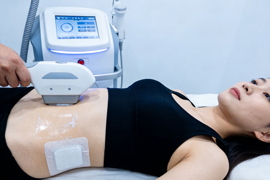 冷冻溶脂瘦腹部