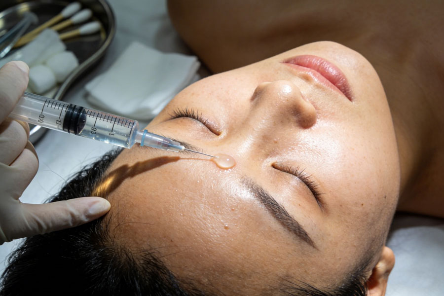 玻尿酸丰额头