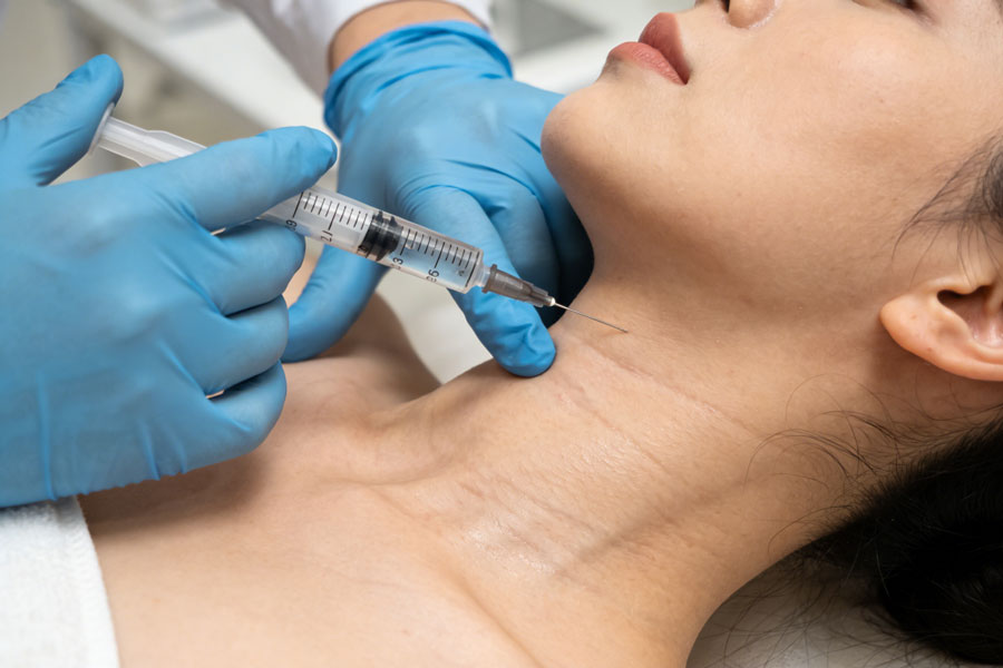 玻尿酸去颈纹