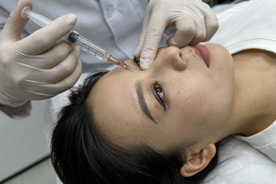 玻尿酸去黑眼圈