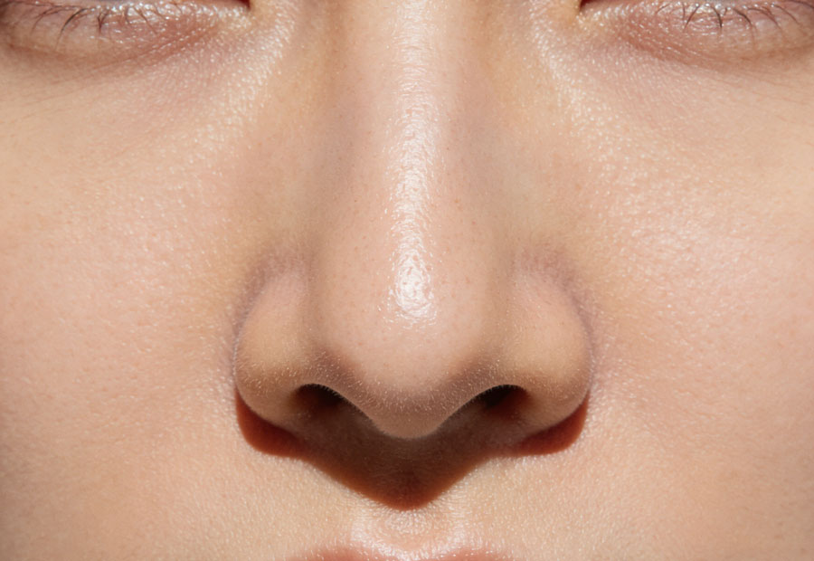 自体软骨垫鼻基底