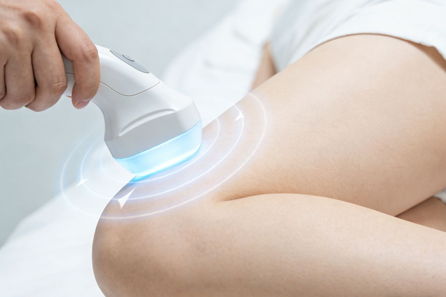 超声溶脂瘦大腿