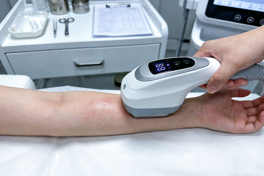 超声溶脂瘦手臂