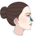 厦门第一医院殷佳鹏擅长什么？双眼皮|隆鼻|微整、技术好、学识扎实