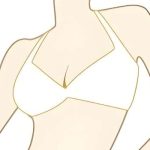 重庆假体隆胸医生口碑榜：果磊、樊东力、林泉、刘正茂内窥镜技术应用