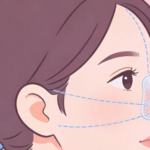 刘中策鼻子案例介绍：驼峰鼻、塌鼻、小宽鼻的术前术后对比详解