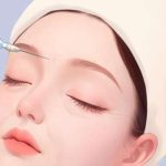 上海九院徐梁医生的号怎么挂？微创注射\双眼皮预约攻略！