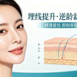 埋线提升后要休息多久？