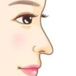 北京八大处陈光宇怎么样？隆鼻2万元起，真实案例分享