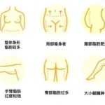 上海九院李华的口碑和评价高不高？医生热门项目技术盘点！