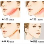 2026年武汉下颌角截骨医生排名实力名单曝光！附医院信息与价格