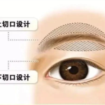 武汉协和医院提眉医生排名！热门专家盘点，技术优势与价格参考