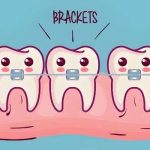 上海正畸陈莉怎么样？医院技术精湛、审美在线