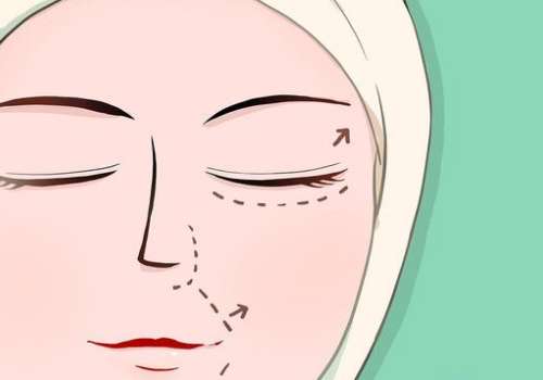 成都宋华敬拉皮怎么样？西区医院技术派、操作细腻_自然不僵硬！