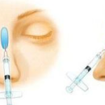 杭州梁敏雪医生擅长什么?眼鼻整形及面部年轻化项目一览