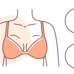 葛海辉隆胸案例深度解析：不同胸型基础、术后曲线对比与风格特点