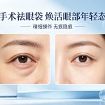 手术祛眼袋后如何护理？