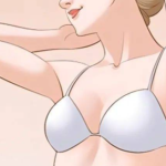 董佳生医生隆胸痛不痛？手术方式、恢复过程和真实感受一次说清