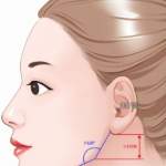 高俊明改脸型怎么样？从颧骨、下颌角到下巴整形的代表案例解析